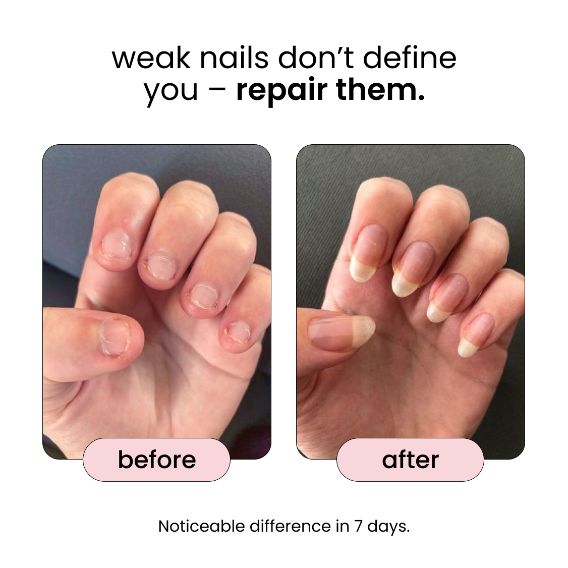 Nail Rejuvenation Oil